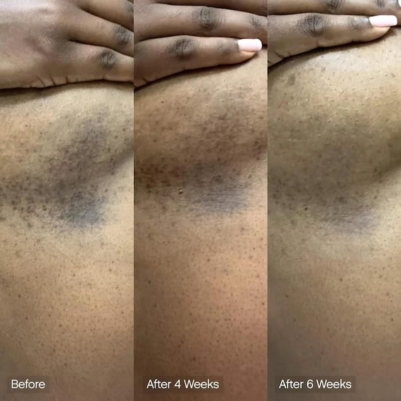 Faded Cleansing Bar for Face and Body | Kojic Acid, Vitamin C & Lactic Acid | Moisturizes | Vegan, Fragrance-Free, Safe for Sensitive Skin (2 Pack)